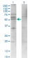 CXCR4 Antibody (monoclonal) (M04)